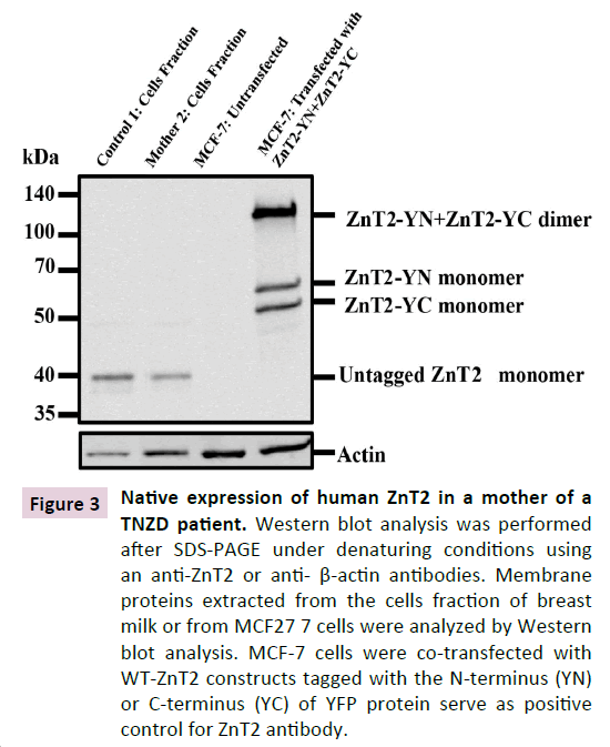 cellular-molecular-medicine-Native-expression