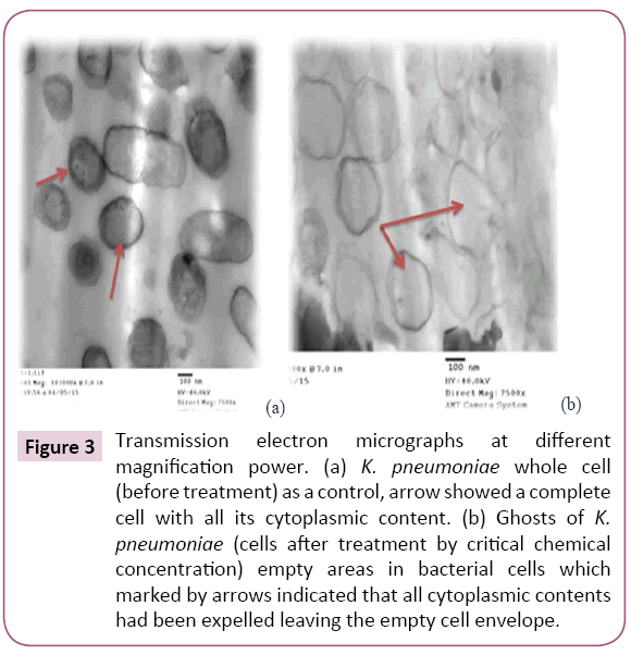 cellular-molecular-medicine-Transmission-electron