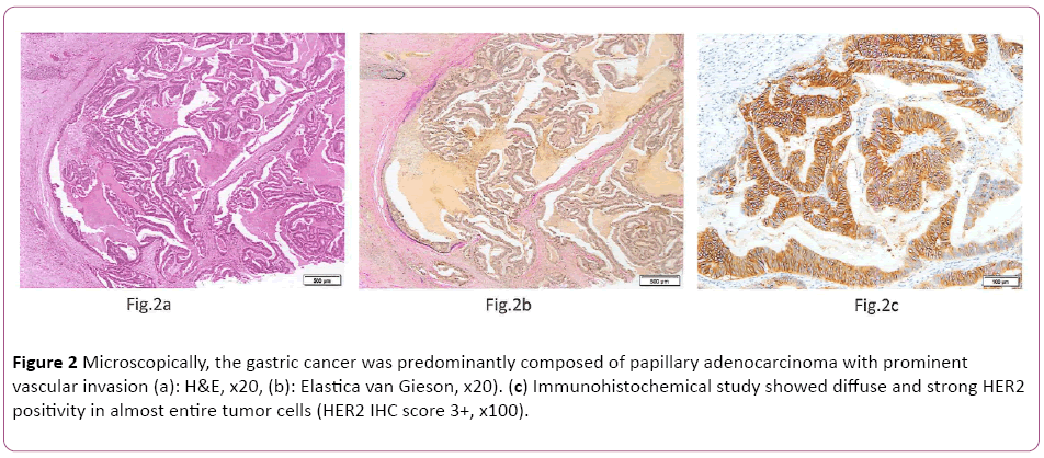 cellular-molecular-medicine-gastric-cancer