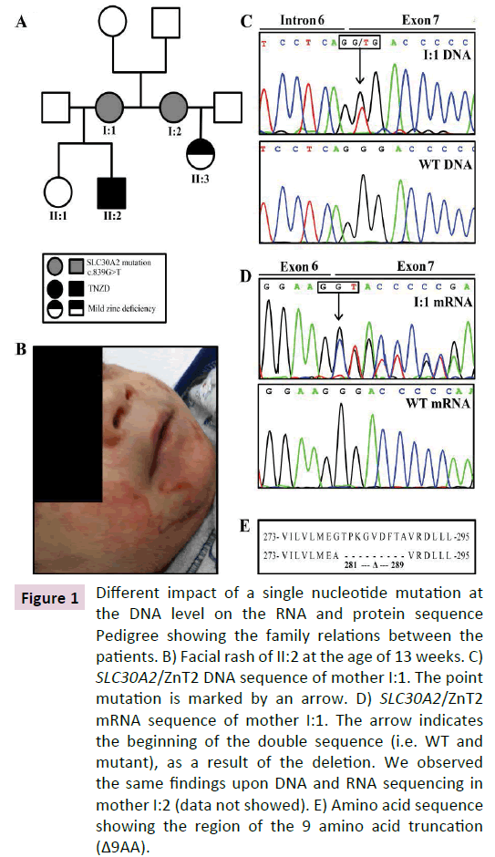 cellular-molecular-medicine-single-nucleotide-mutation