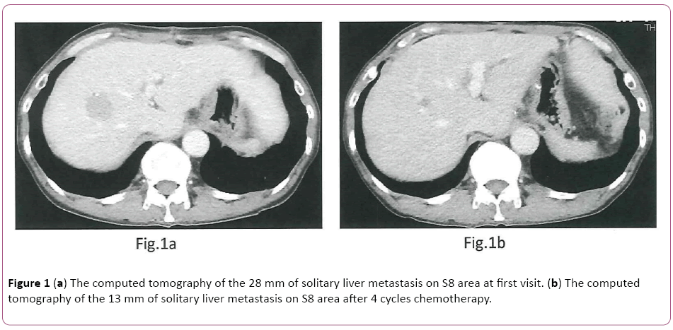 cellular-molecular-medicine-solitary-liver